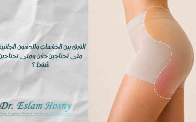 الفرق بين الخفسات والدهون الجانبية: متى تحتاجين حقن ومتى تحتاجين شفط؟