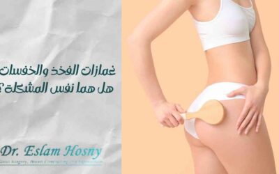 غمازات الفخذ والخفسات: هل هما نفس المشكلة؟
