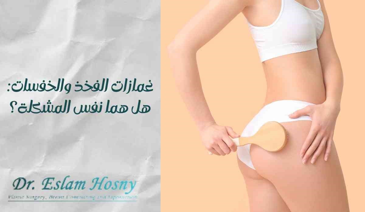 غمازات الفخذ والخفسات: هل هما نفس المشكلة؟ غمازات الفخذ والخفسات: هل هما نفس المشكلة؟