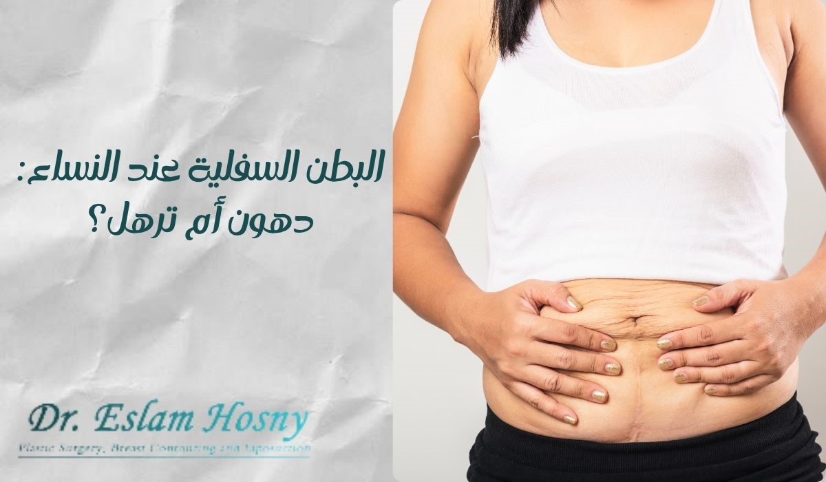 البطن السفلية عند النساء: دهون أم ترهل؟