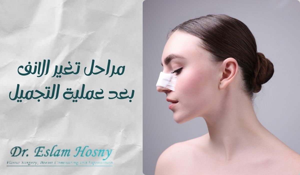 مراحل تغير الانف بعد عملية التجميل​