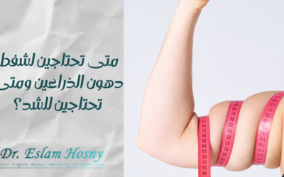 متى تحتاجين لشفط دهون الذراعين ومتى تحتاجين للشد؟